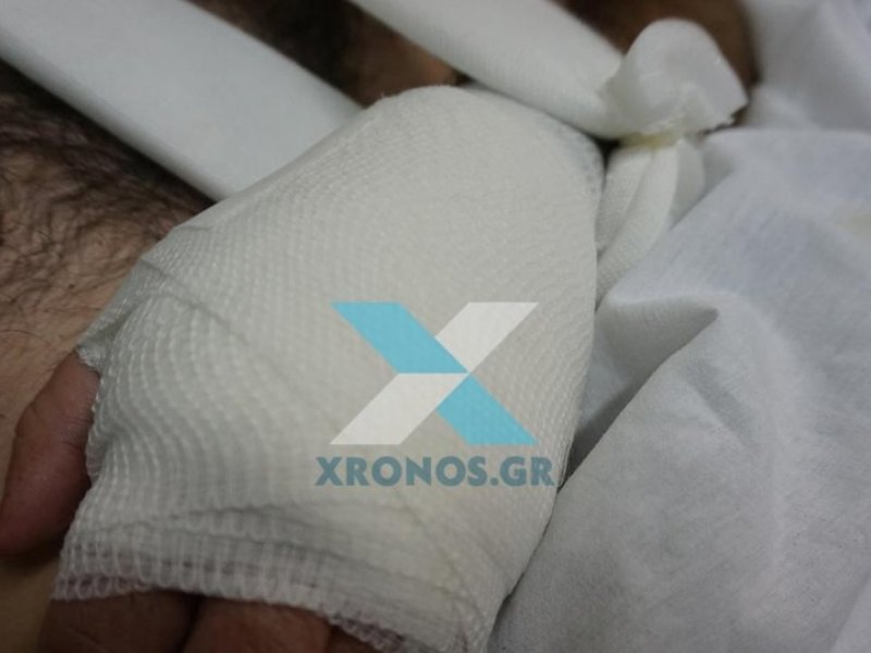 Κομοτηνή: Επίθεση παράνομου μετανάστη σε αστυνομικό (Photos)