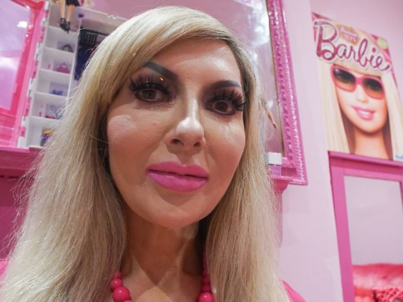 Aνθρώπινη Barbie: Η μανία της τελειότητας
