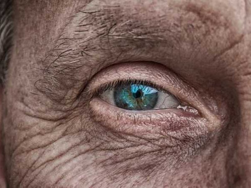 Γλαύκωμα: Οι διαβητικοί κινδυνεύουν περισσότερο
