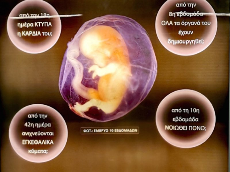 Αποσύρεται από το μετρό η διχαστική αφίσα κατά των αμβλώσεων