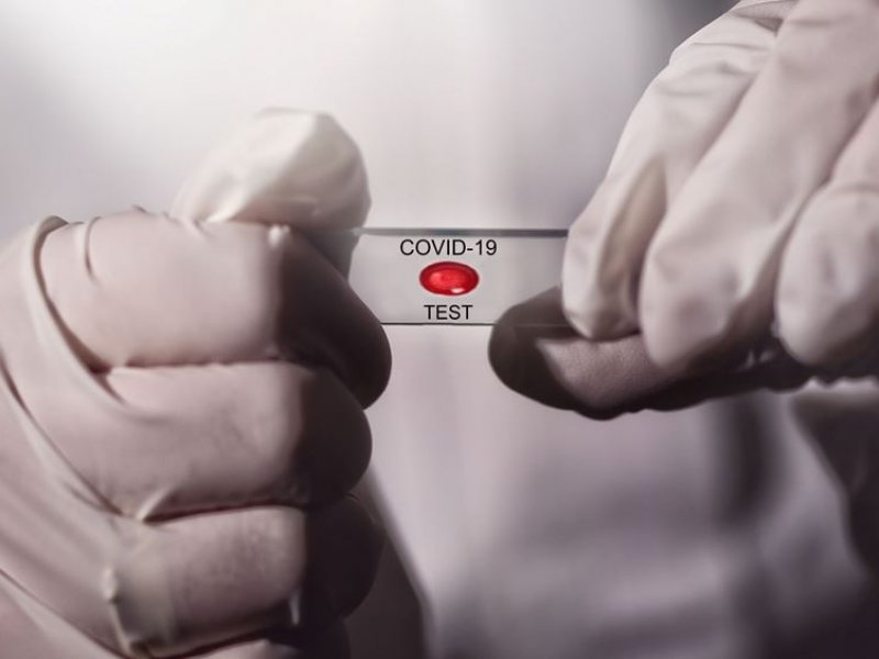 Sinovac Biotech: Εμβόλιο κατά του κορονοϊού αποτελεσματικό σε πιθήκους