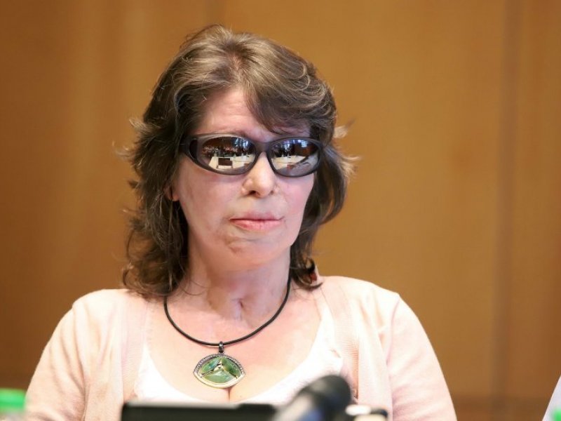 Κωνσταντίνα Κούνεβα: Τώρα ξεκινάει ο Γολγοθάς της κοπέλας - Αυτό το υγρό σε καίει 20 μέρες