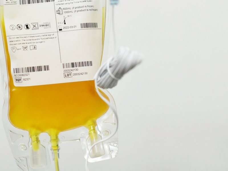 Σε 16 ασθενείς από COVID-19 στην Ελλάδα έχει χορηγηθεί πλάσμα ιαθέντων