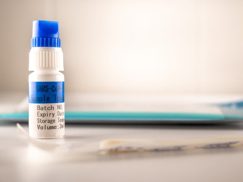 Πού θα γίνονται αύριο Τρίτη δωρεάν rapid test