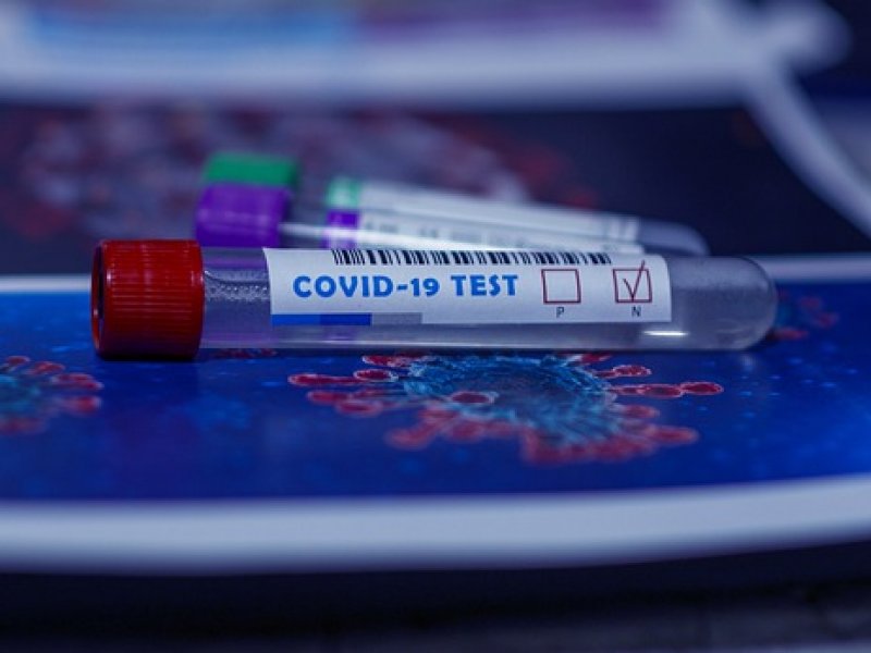 ΕΟΔΥ: Πού γίνονται σήμερα δωρεάν rapid test