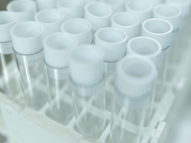 Κορονοϊός - PCR test: «Κλείδωσε» το πλαφόν τιμής στα 50 ευρώ - Αναμένονται ανακοινώσεις Γεωργιάδη
