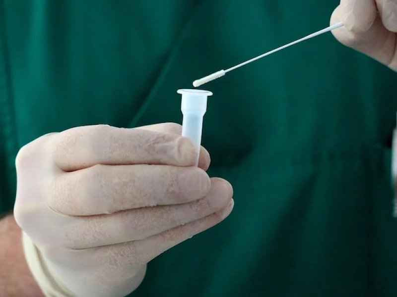 ΕΟΔΥ: Πού θα γίνονται δωρεάν rapid test αύριο Μεγάλη Δευτέρα