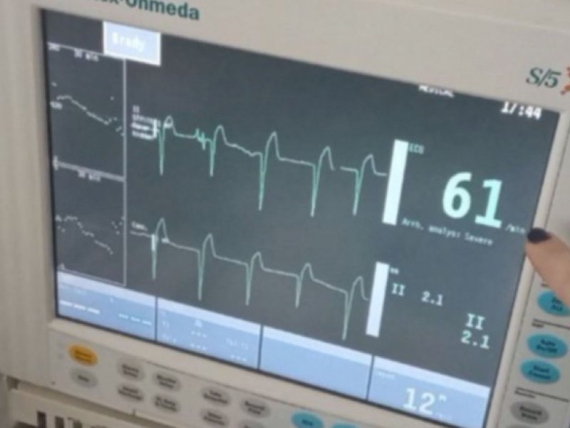 Ιατροδικαστής Καρακούκης για τα τρία παιδιά στην Πάτρα: «Θα βρούμε τι συνέβη» (Βίντεο)