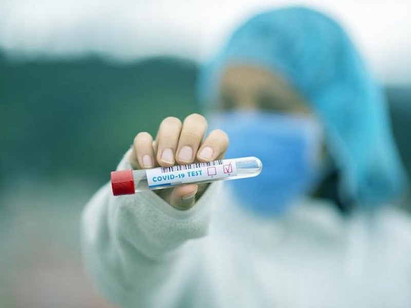 ΕΟΔΥ: Πού θα διενεργούνται δωρεάν rapid test σήμερα Σάββατο 16 Ιουλίου